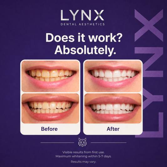 Lynx Purple Teeth Whitening Strips
